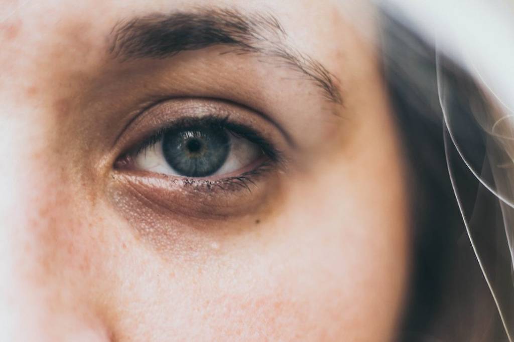 Mulher com olhos claros e olheiras profundas olha para a câmera