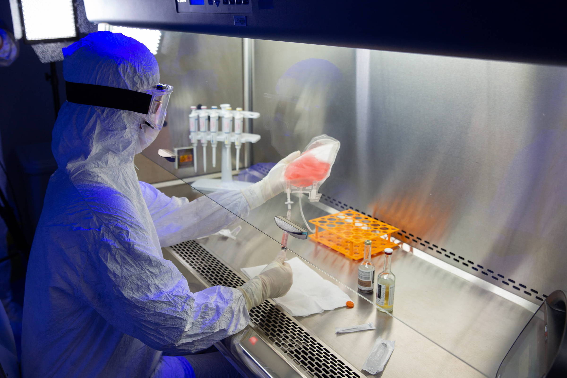 Terapia CAR-T é aprovada em estudo para câncer gástrico - 09/06/2025 - Equilíbrio e Saúde