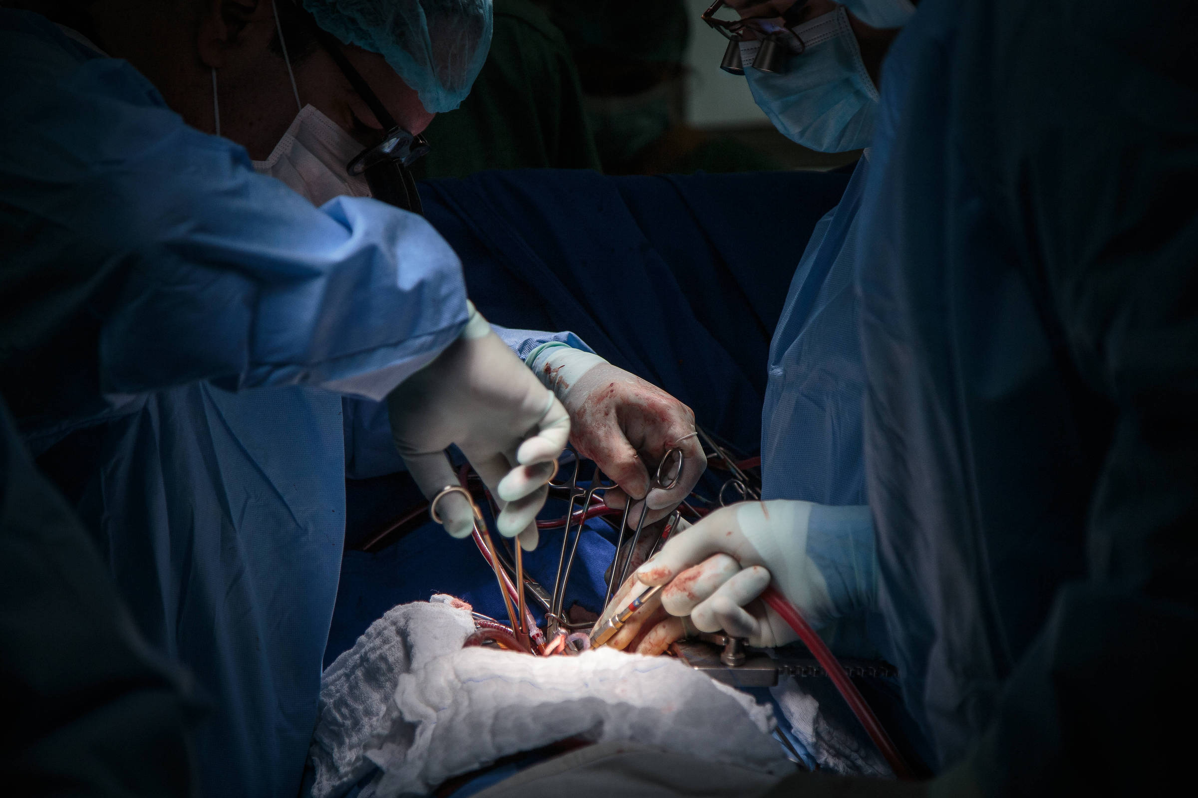 A imagem mostra um procedimento cirúrgico em andamento, com dois profissionais de saúde usando roupas cirúrgicas, luvas e máscaras. Eles estão concentrados em uma área coberta por um pano cirúrgico, onde são visíveis instrumentos cirúrgicos e tubos. A iluminação é focada na área da cirurgia, criando um contraste com o fundo mais escuro.
