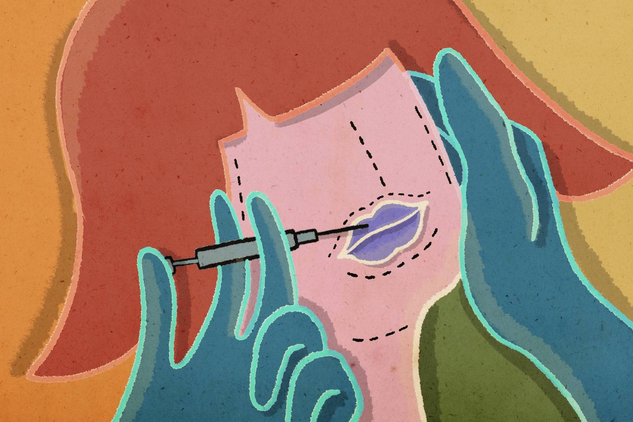 A ilustração apresenta uma representação simbólica de um procedimento estético. Uma pessoa com cabelos avermelhados aparece de perfil, com o rosto marcado por linhas pontilhadas, sugerindo áreas a serem modificadas. Um par de mãos com luvas azuis segura o rosto e aplica uma injeção nos lábios, que estão destacados em tons de roxo e delineados de forma acentuada. A cena utiliza cores vibrantes e contrastantes, evocando a tensão entre beleza idealizada e transformação corporal, destacando a influência da estética e dos procedimentos cosméticos na construção da imagem pessoal.