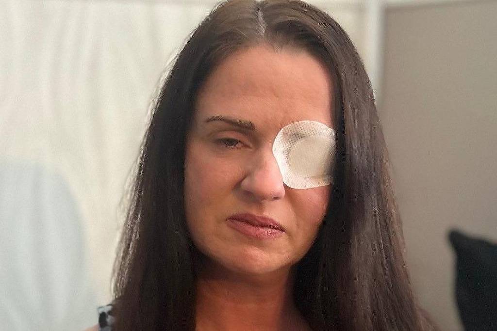 A imagem mostra uma mulher com cabelo longo e liso, usando um curativo sobre um dos olhos. Ela tem uma expressão séria e está olhando para a câmera. O fundo é desfocado, mas parece ser um ambiente interno, possivelmente uma sala de estar.